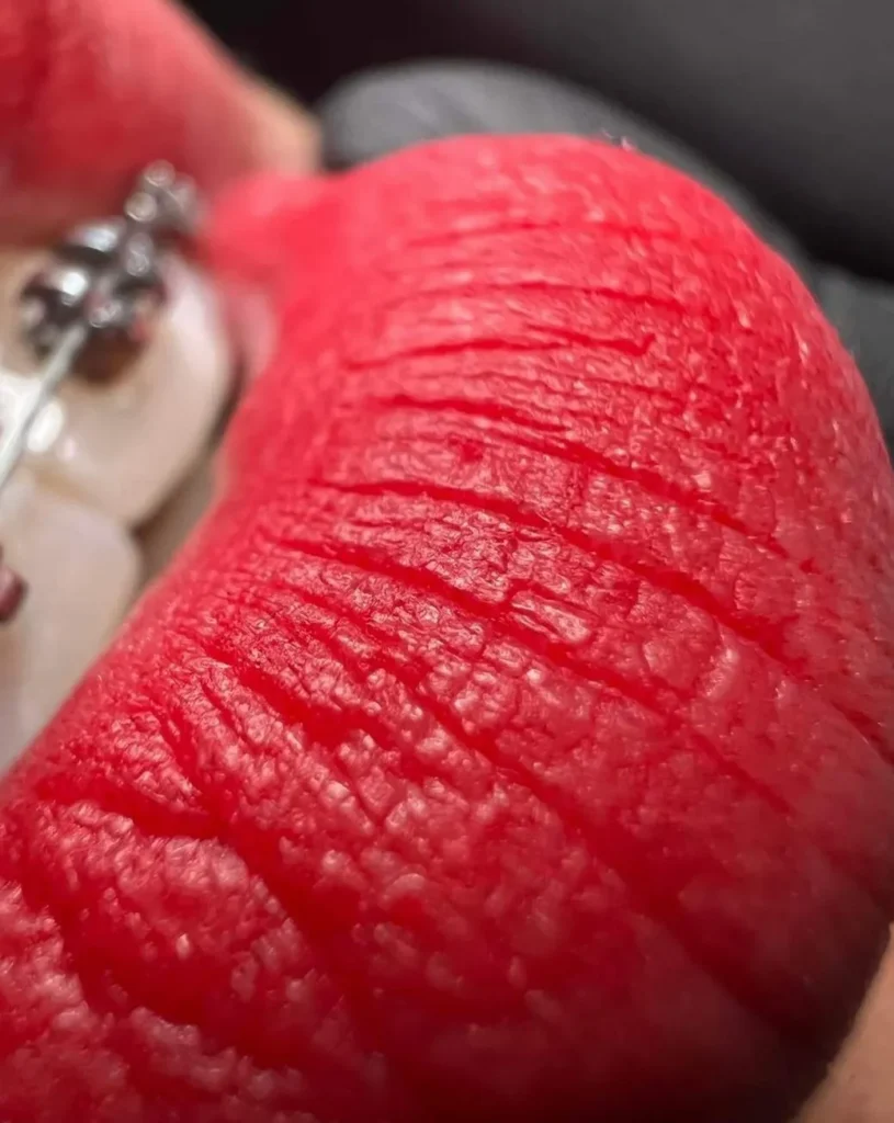 Can You Vape After Getting a Lip Tattoo