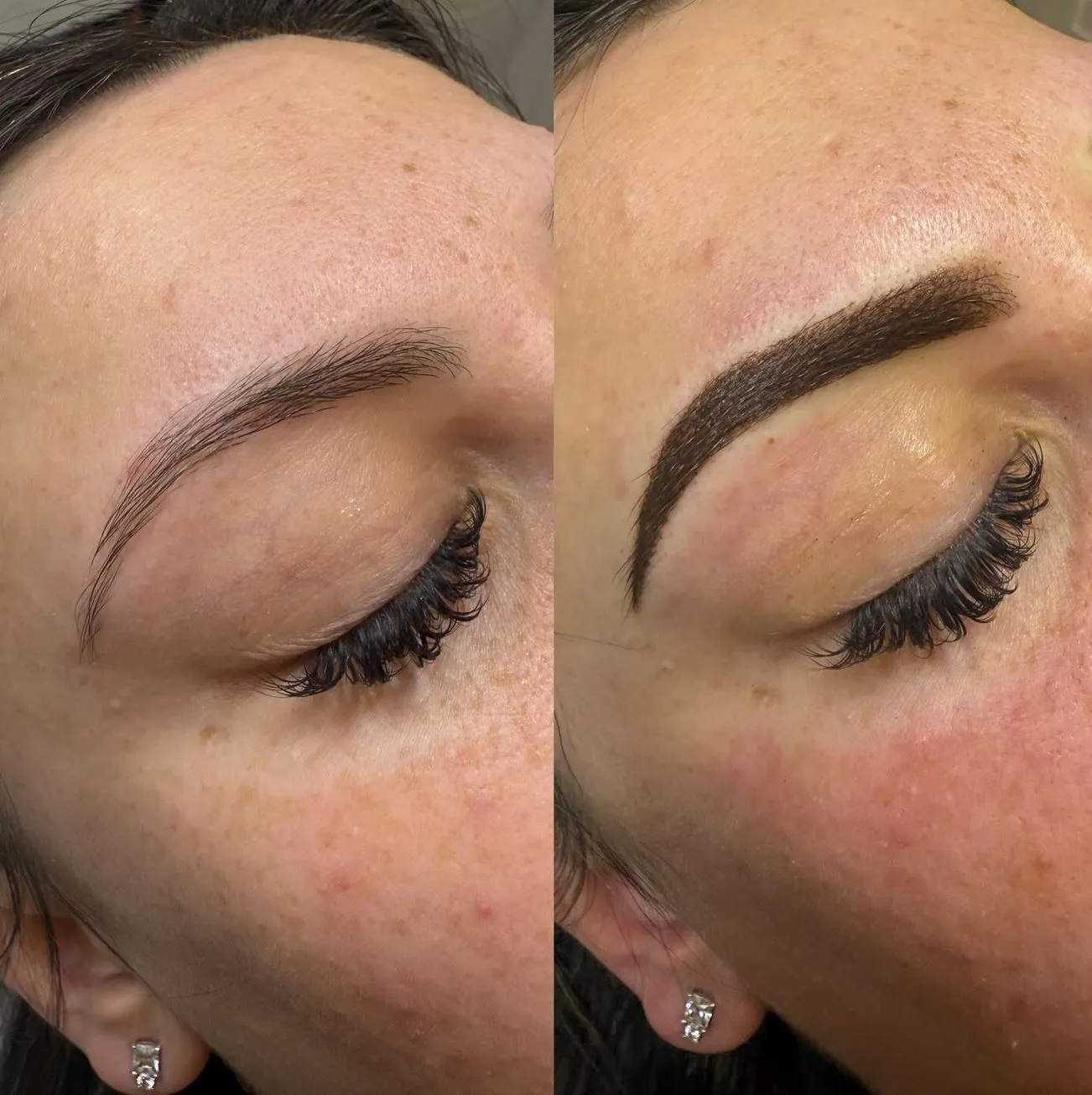 Does Skin Type Affect Fading