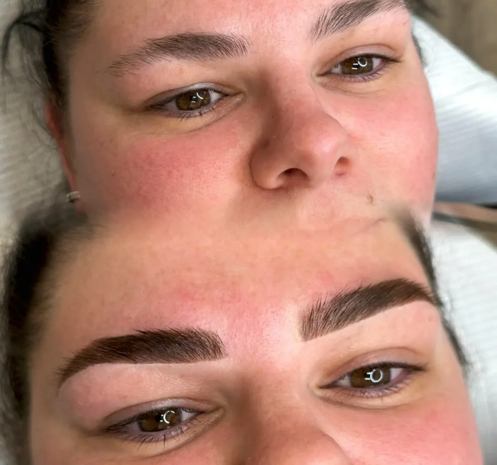 How Can I Speed Up Healing After Eyebrow Tattooing