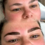 How Can I Speed Up Healing After Eyebrow Tattooing