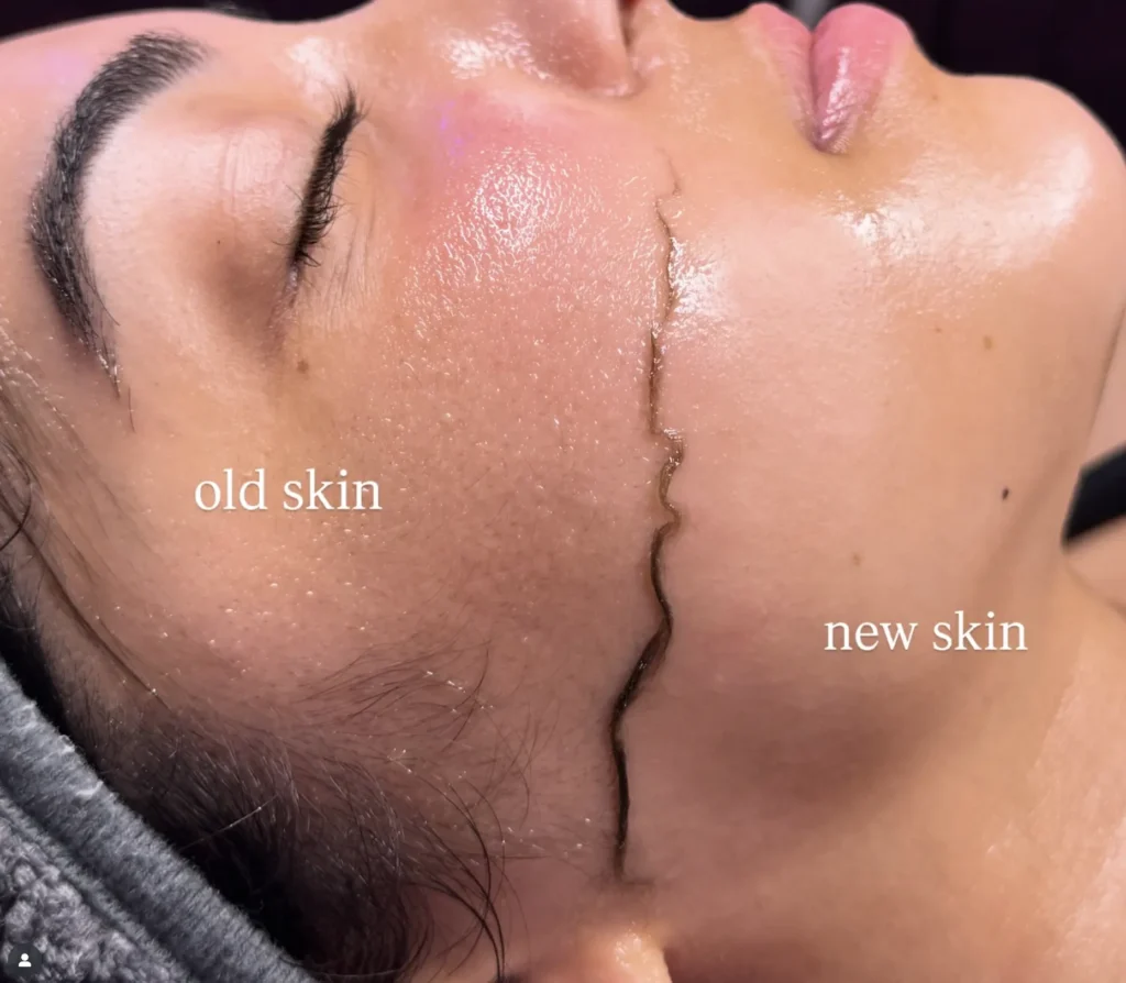 Skinimalism Meets Pro-Tools