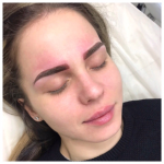 Managing Allergic Reactions to Eyebrow Tint: Immediate Relief & Prevention Tips